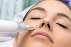 Best Actinic Keratoses Removal 3 Actinic keratoses Malvern Link solutions - book in today!