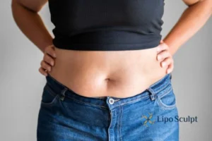 Bidding Farewell to Muffin Tops with Aqualyx Fat Injections 2 Do you wish you could reduce your muffin top Malvern Link With Aqualy fat dissolving injections you can!